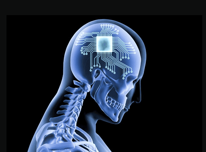 Implan Biomedis Berbasis AI