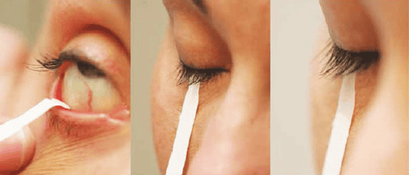 Air Mata Menjadi Alat Diagnostik